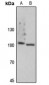 Anti-Focal Adhesion Kinase (pY861) Antibody