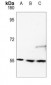 Anti-RAD23B Antibody