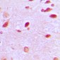 Anti-RAP1GAP Antibody