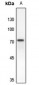 Anti-RAP1GAP Antibody