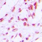 Anti-RB1 (pS780) Antibody