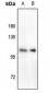 Anti-RB1 (pS780) Antibody