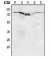 Anti-NF-kappaB p65 (pS536) Antibody