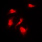 Anti-S6K1 (pS418) Antibody