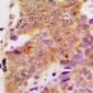 Anti-S6K1 (pS418) Antibody