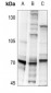 Anti-S6K1 (pS418) Antibody