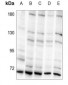 Anti-S6K1 (pT421) Antibody