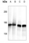 Anti-CLIP1 Antibody