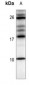 Anti-CXCL12 Antibody