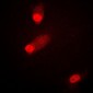 Anti-MKK4 (pS80) Antibody