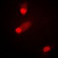 Anti-MKK4 (pS80) Antibody