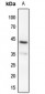 Anti-MKK4 (pS80) Antibody