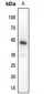 Anti-MKK4 (pT261) Antibody