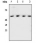 Anti-SHB (pY246) Antibody