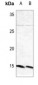 Anti-Beta-synuclein Antibody