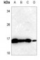 Anti-SOD1 Antibody