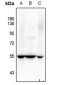 Anti-SOX9 (pS181) Antibody