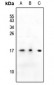 Anti-SSBP1 Antibody