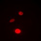 Anti-STAT3 (pS727) Antibody