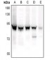 Anti-STAT3 (pS727) Antibody
