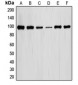 Anti-STAT6 Antibody