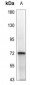 Anti-SYK (pY323) Antibody