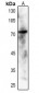 Anti-SYK (pY348) Antibody