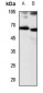 Anti-CD156b Antibody