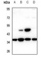 Anti-TCF19 Antibody