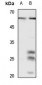 Anti-CD141 Antibody