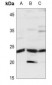 Anti-TIMP2 Antibody