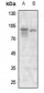 Anti-CD284 Antibody