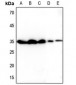 Anti-Tetraspanin 8 Antibody