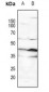 Anti-p53 (pS15) Antibody