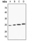 Anti-TCTP Antibody