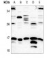 Anti-SUMO1 Antibody