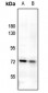 Anti-Uromodulin Antibody