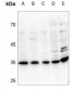 Anti-UDG Antibody