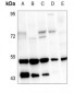 Anti-VDR Antibody