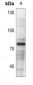 Anti-Vitronectin Antibody