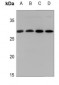Anti-14-3-3 zeta (pS58) Antibody