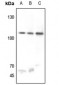 Anti-USP11 Antibody