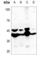 Anti-MMP23 Antibody