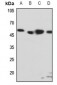 Anti-EDG6 Antibody