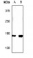 Anti-MRP3 Antibody