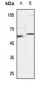 Anti-SNX4 Antibody