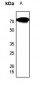 Anti-CES2 Antibody