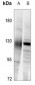 Anti-Neuropilin 1 Antibody