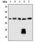 Anti-SOCS2 Antibody