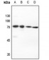 Anti-PIAS2 Antibody